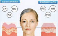   胶原蛋白肽粉的这个作用,让你回粉嫩女生