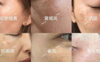 胶原蛋白肽与抗衰老和丰胸