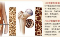 同源颐泰牛骨髓钛粉有什么效果？多少钱一盒？