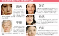 小分子肽可以补充胶原蛋白吗？鱼胶原蛋白肽对皮肤的养护作用！