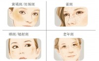 揭秘：玉肌容颜鹿胎珍珠美白祛斑胶囊真有祛斑效果吗？