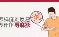 小分子肽能治疗慢性荨麻疹？