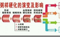 血管循环不好血管堵塞怎么办？降血脂软血管吃地龙蛋白肽效果怎么样？