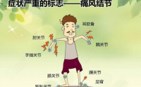 怎么判断关节红肿是不是痛风性关节炎？高尿酸与痛风的关系