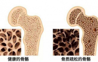 胶原蛋白肽在预防和治疗骨质疏松方面的研究（研究报告分享会原文）