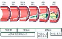 血管怎么老化了？小分子肽与预防修复血管老化的作用！