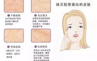 女人皮肤养护吃胶原蛋白肽可以吗,胶原蛋白肽对皮肤的作用