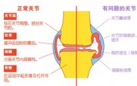 金木同源堂双青胶囊补骨髓与骨质疏松骨关节疾病的作用