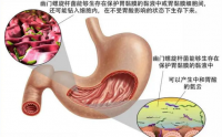 四联疗法能不能根除幽门螺杆菌