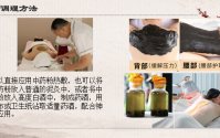 富贵包是什么原因导致的，中医传统手法调整富贵包