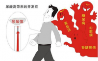 痛风不仅仅是痛，这些并发症太可怕！