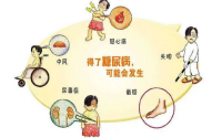 小分子肽在预防和治疗糖尿病并发症中的作用