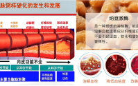 动脉硬化吃纳豆激酶有起什么作用,纳豆激酶能溶解颈动脉斑块吗？