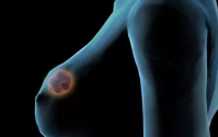 乳腺增生服用小分子活性肽有什么好处吗？
