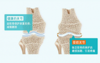 胶原蛋白肽对骨骼的营养与作用