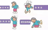女人更年期为什么容易出现骨折,更年期女性如何预防骨折骨质疏松？