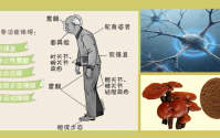 灵芝多糖对帕金森病的作用是什么,灵芝多糖适合帕金森病人吃吗?