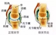 补充胶原蛋白肽骨骼和关节健康的作用