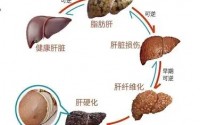 肝功能不好有哪些表现,肝功能不好怎么调理？