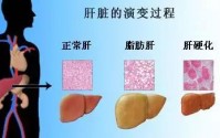 肝病吃小分子肽可以吗？小分子肽对不同肝病起到的作用是什么？
