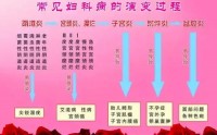 抑菌宫粉对妇科炎症效果怎么样？抑菌宫粉的主要作用有哪些？