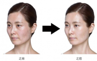 胶原蛋白在身体中的分布_不仅限于皮肤