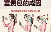 富贵包是怎么形成的？富贵包调理与技术加盟