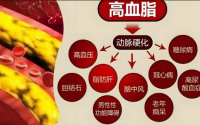 人参牛骨髓肽对高血脂的作用？服用牛骨髓复合肽多久能降血脂