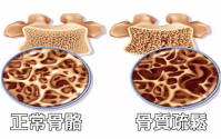 你的骨头正在悄悄变“糠”！赶紧补充牛骨髓肽乳矿盐固体饮料