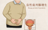 菊苣枸杞子多糖对前列腺的作用