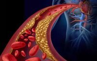 干细胞疗治对治疗动脉硬化有哪些具体作用？