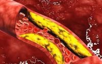 地龙蛋白活性多肽的主要功能作用有哪些？地龙蛋白溶解血栓效果怎么样？