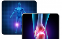 膝关节骨病关节炎患者一定要服用一下胶原蛋白肽