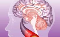 脑血栓病人能吃小分子活性肽吗？如何预防脑血栓？