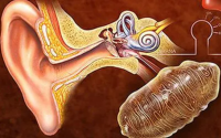 干细胞注射疗法在治疗耳聋中的应用，干细胞与耳聋