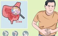 肠胃不好怎么办如何调理肠胃,肠胃炎可以吃胶原蛋白肽吗