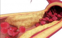 大豆小分子活性肽在降血脂方面的研究