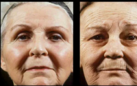 皮肤老化的生物现象与原理，胶原蛋白肽与皮肤抗衰老
