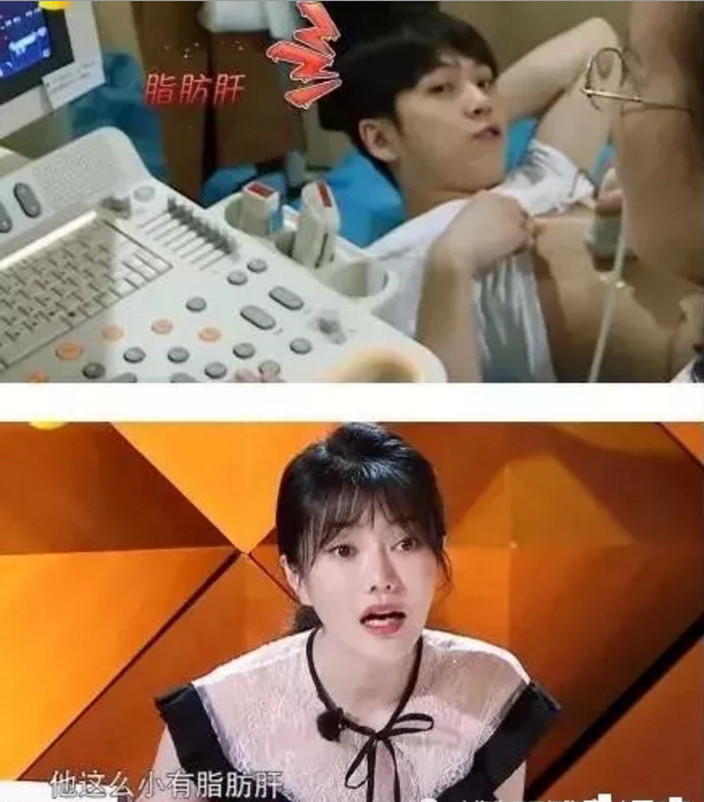 脂肪肝怎么治疗.png