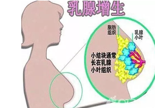 国珍肽对乳腺增生有帮助吗.png