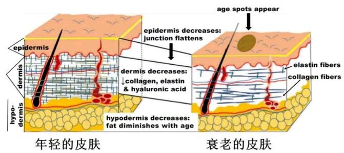 皮肤老化.jpg