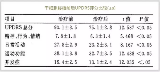 干细胞与对帕金森的效果怎么样.png