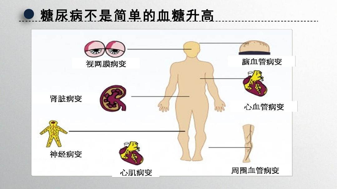 糖尿病慢性并发症.jpg
