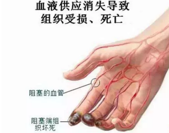 小分子肽对静脉曲张效果怎么样.png 小分子肽对静脉曲张效果怎么样.png