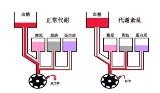 2型糖尿病具体是什么原因.png