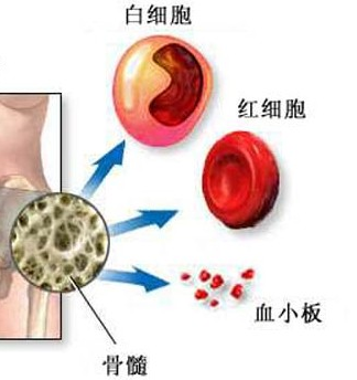 再生障碍性贫血.png 再生障碍性贫血.png