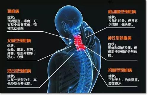 颈椎病1.jpg