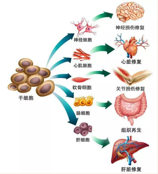 干细胞治疗肝硬化.png