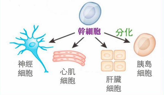 干细胞与糖尿病.png