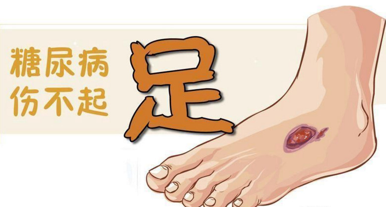 肽能治疗糖尿病病足吗.png